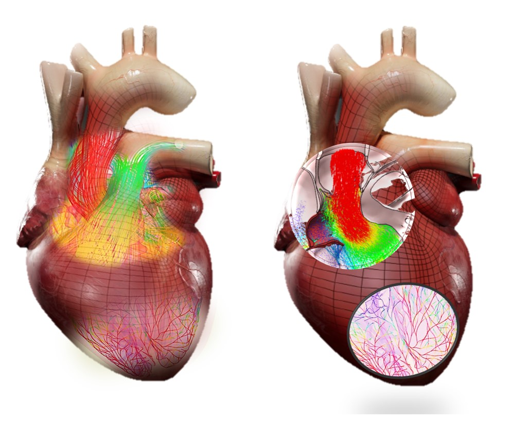 Living Heart: Dassault Systèmes Testa Gêmeos Virtuais Personalizados para Acelerar Inovações Médicas